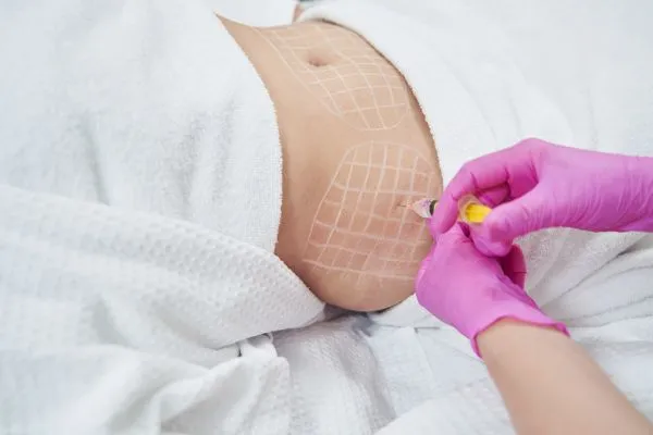 image of fat dissolving injections on love handles to help combat weight gain Redditch