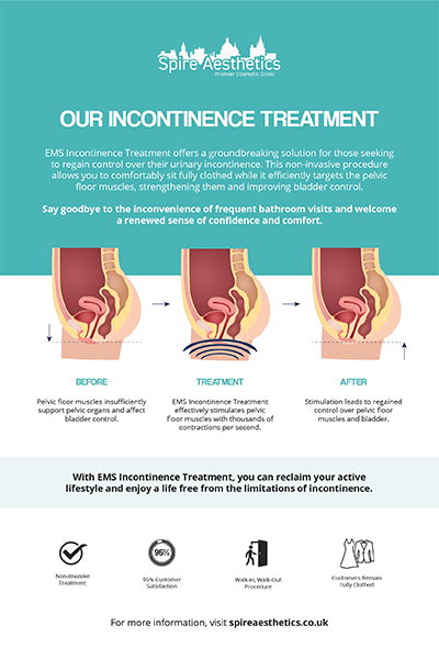 image of how urge incontinence Redditch treatment works
